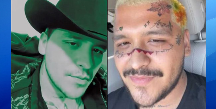 CHRISTIAN NODAL SIN TATUAJES EN LA CARA