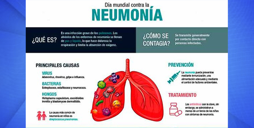 NEUMONÍA, UNA DE LAS PRINCIPALES CAUSAS DE ATENCIÓN HOSPITALARIA EN MÉXICO