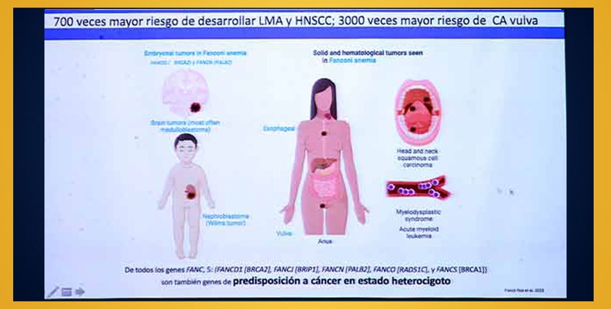 CONTRIBUYE LA UNAM AL DIAGNÓSTICO TEMPRANO DE ENFERMEDAD ULTRARRARA